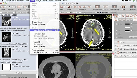 Escape Medical Viewer For Mac